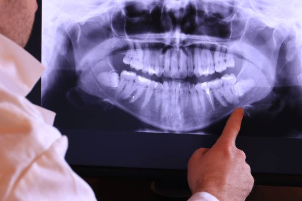 Best Emergency Wisdom Teeth Removal in San Luis, AZ